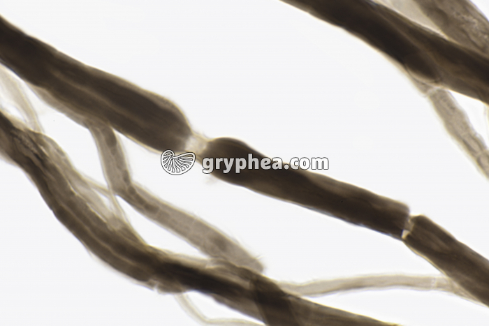 Noeuds de Ranvier Nerf AO dissociation x100 - gryphea.com